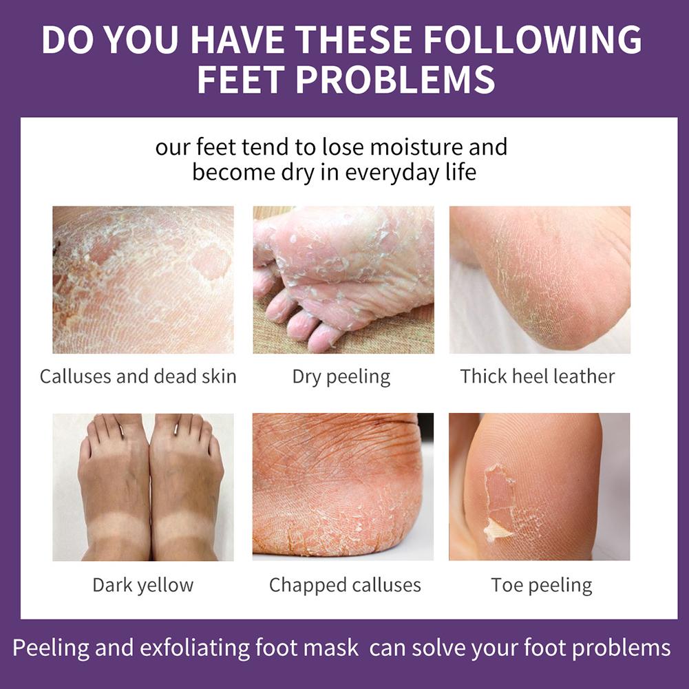 Máscara para os pés com essênc - Foot Mask Peeling avaliação e preço