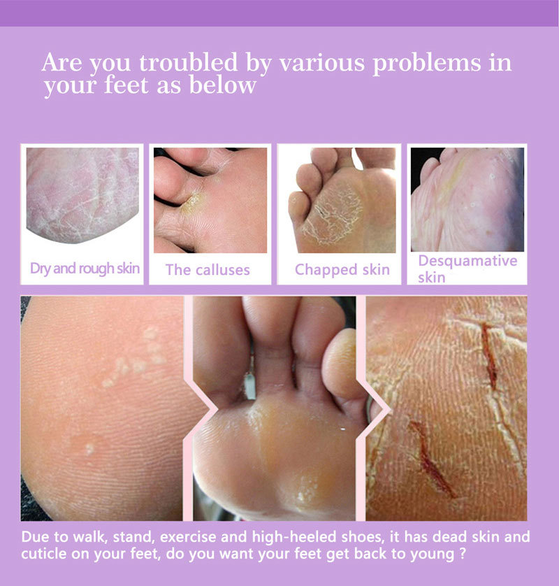 Máscaras esfoliantes para os p - Foot Mask Peeling avaliação e preço