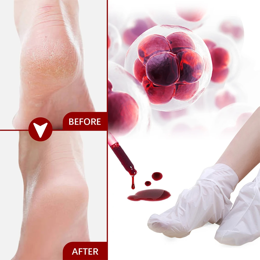 5/2/1 pares máscara de pé ácid - Foot Mask Peeling avaliação e preço